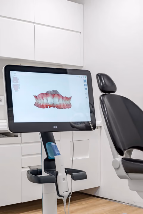 Escáner intraoral de la clínica con un modelo dental digital en pantalla